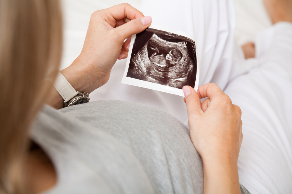 Pregnant woman looking at ultrasound